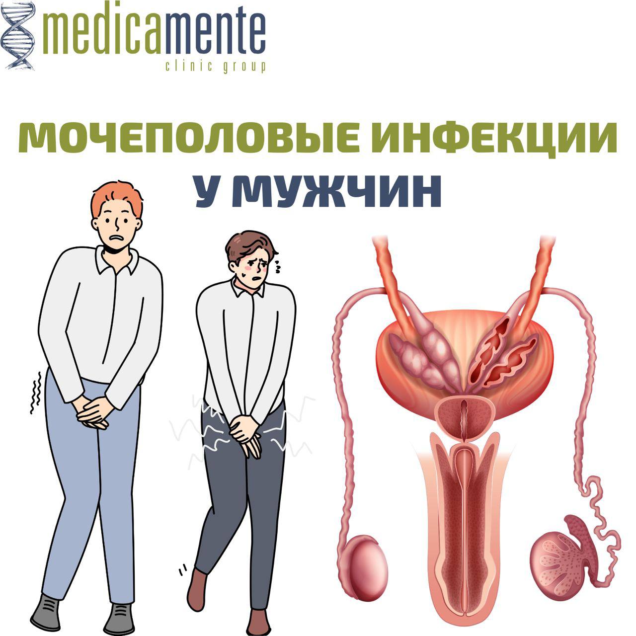 Мочеполовые инфекции у мужчин
